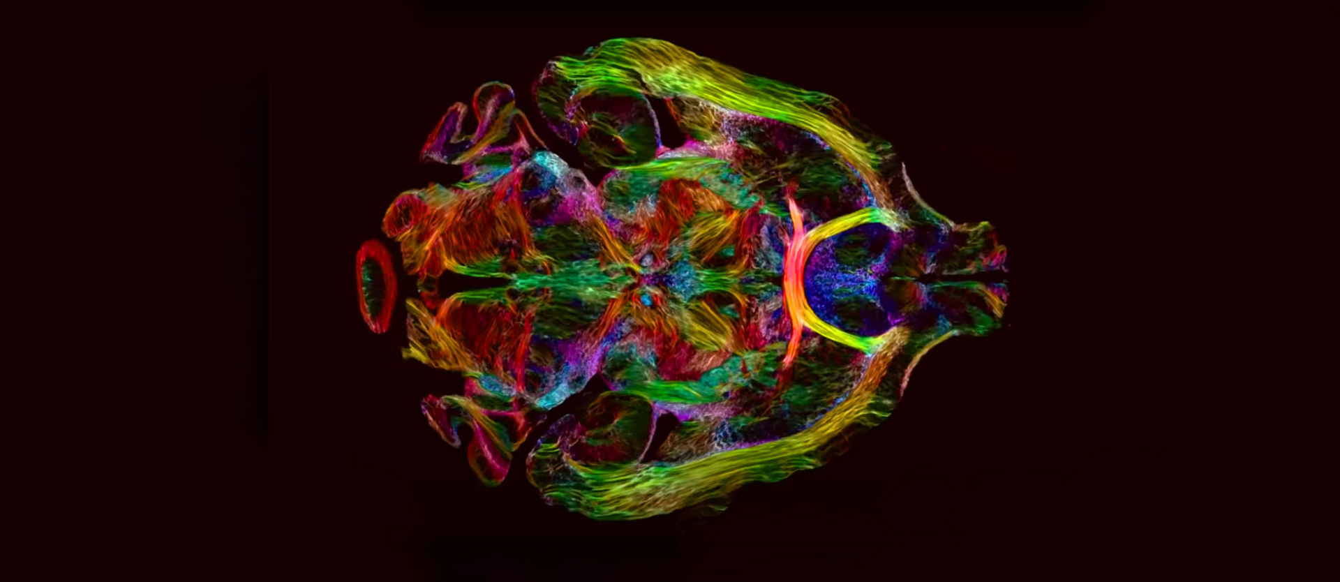 Deep inside the mouse brain